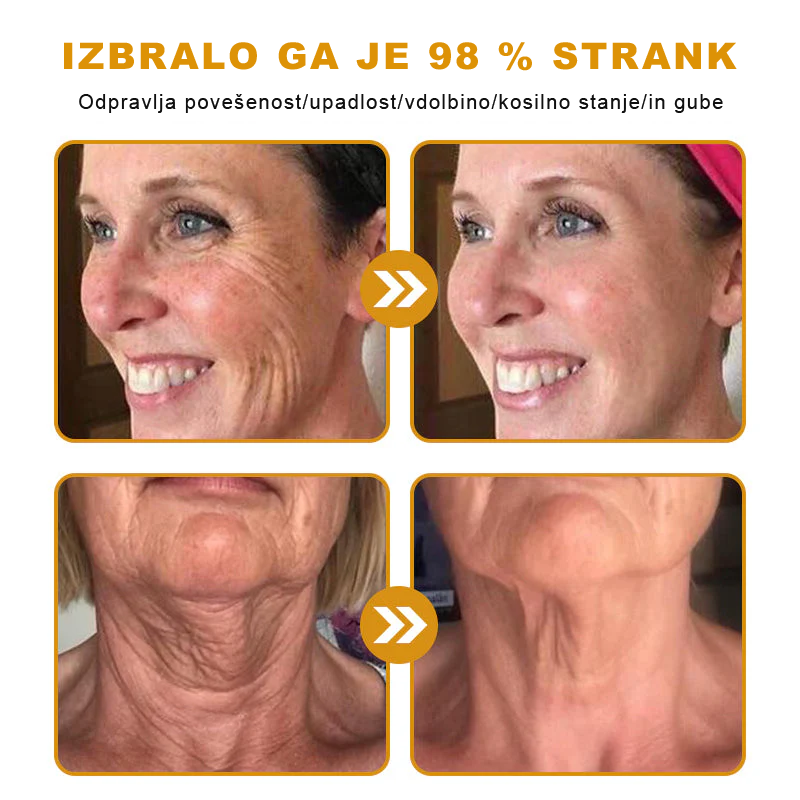 👩‍⚕️Sinvie® krema s čebeljim strupom | 50 ml | Profesionalna formula za nego in obnovo kože