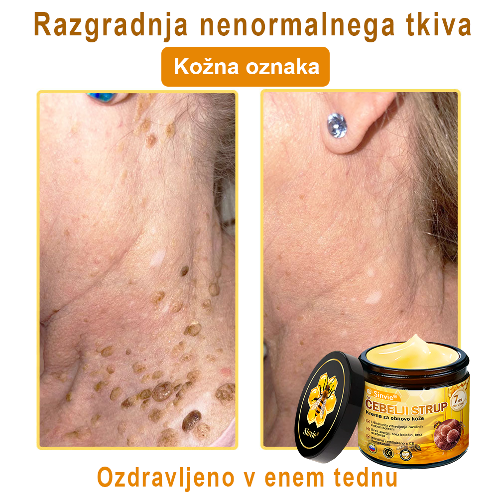 👩‍⚕️👩‍⚕️Sinvie® krema s čebeljim strupom | 50 ml | Profesionalna formula za nego in obnovo kože