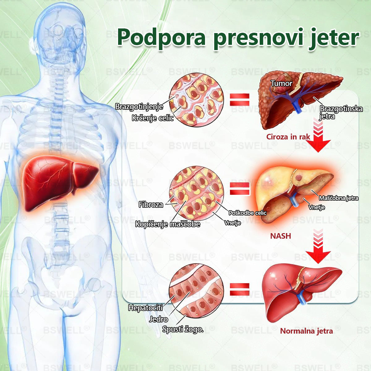 🔥BSWELL® Nano mikroneedling shujševalni obliž (Samo enkrat na dan, vidne spremembe v 28 dneh)  ✅ Za debelost, zdravje srca in ožilja, sladkorno bolezen, spalno apnejo, zdravje črevesja, težave s sklepi in še več.