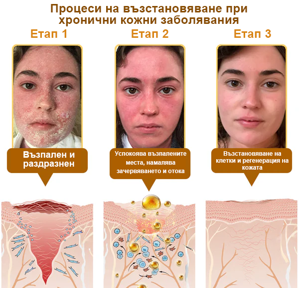 🔥𝐍𝐎𝐑𝐔𝐈𝐎𝐍® регенериращ крем с пчелна отрова | 50 мл | Препоръчан от Българското дерматовенерологично дружество