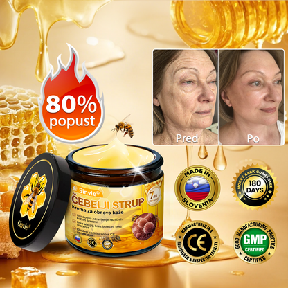 🎁Sinvie® Na voljo je samo še 5 škatel! Zagotovite si dodatnih 50 % popusta.    Če zamudite zdaj, takšne priložnosti prihodnje leto morda ne bo več.