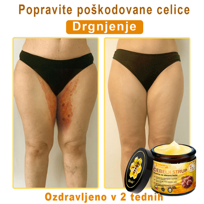 👩‍⚕️Sinvie® krema s čebeljim strupom | 50 ml | Profesionalna formula za nego in obnovo kože