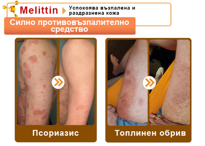 🔥𝐍𝐎𝐑𝐔𝐈𝐎𝐍® регенериращ крем с пчелна отрова | 50 мл | Препоръчан от Българското дерматовенерологично дружество