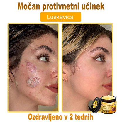 🎁Sinvie® Na voljo je samo še 5 škatel! Zagotovite si dodatnih 50 % popusta.    Če zamudite zdaj, takšne priložnosti prihodnje leto morda ne bo več.