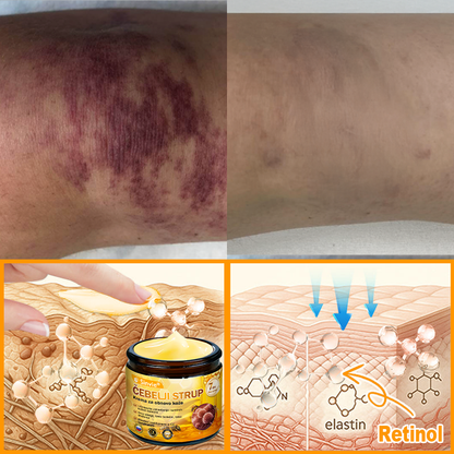 👩‍⚕️Sinvie® krema s čebeljim strupom | 50 ml | Profesionalna formula za nego in obnovo kože