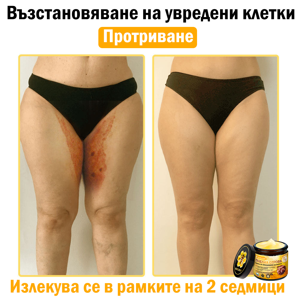 🔥𝐍𝐎𝐑𝐔𝐈𝐎𝐍® регенериращ крем с пчелна отрова | 50 мл | Препоръчан от Българското дерматовенерологично дружество