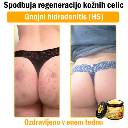 🎁Sinvie® Na voljo je samo še 5 škatel! Zagotovite si dodatnih 50 % popusta.    Če zamudite zdaj, takšne priložnosti prihodnje leto morda ne bo več.