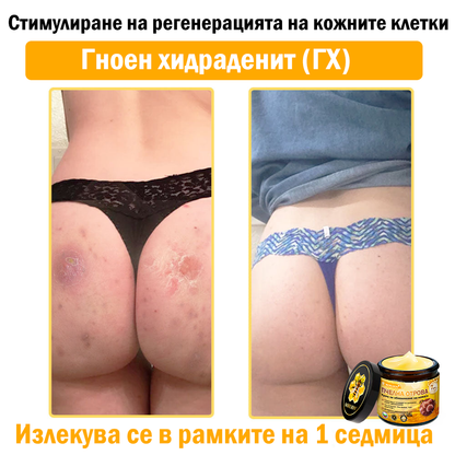 🔥𝐍𝐎𝐑𝐔𝐈𝐎𝐍® регенериращ крем с пчелна отрова | 50 мл | Препоръчан от Българското дерматовенерологично дружество